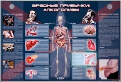 Электрифицированный стенд "Вредные привычки: алкоголизм" - fgospostavki.ru - Радужный