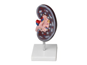 Модель почки в разрезе - fgospostavki.ru - Радужный