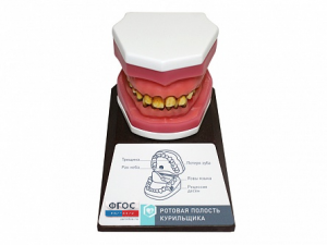 Демонстрационная модель "Ротовая полость курильщика" - fgospostavki.ru - Радужный